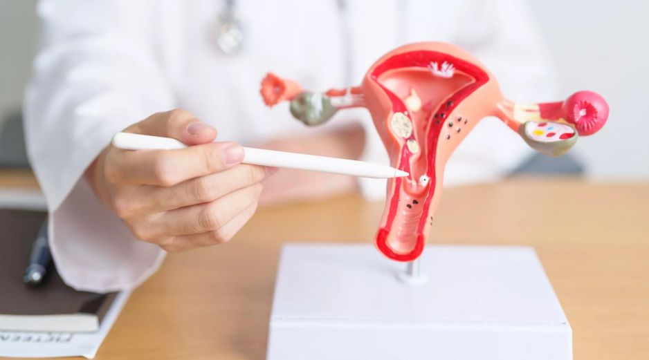 Esta anomalía fisiológica impide que los ovarios liberen óvulos de forma regular y predecible, afectando directamente la fertilidad, la planificación familiar y el ciclo natural del cuerpo femenino. ESPECIAL