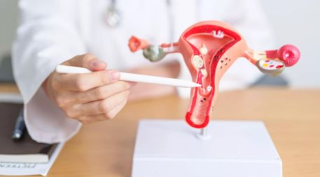 Esta anomalía fisiológica impide que los ovarios liberen óvulos de forma regular y predecible, afectando directamente la fertilidad, la planificación familiar y el ciclo natural del cuerpo femenino. ESPECIAL