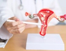 Esta anomalía fisiológica impide que los ovarios liberen óvulos de forma regular y predecible, afectando directamente la fertilidad, la planificación familiar y el ciclo natural del cuerpo femenino. ESPECIAL