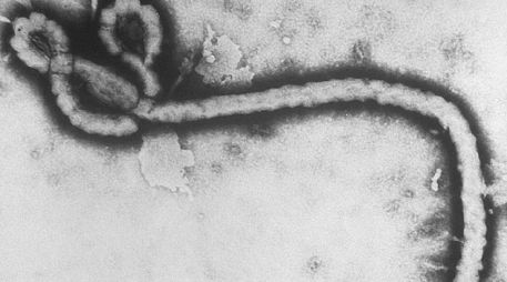 Aunque el riesgo de propagación del Ébola a otras regiones de América es bajo si se aplican los protocolos adecuados, la globalización actual exige que ninguna alerta sanitaria internacional sea ignorada. AP/ARCHIVO