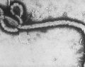 Aunque el riesgo de propagación del Ébola a otras regiones de América es bajo si se aplican los protocolos adecuados, la globalización actual exige que ninguna alerta sanitaria internacional sea ignorada. AP/ARCHIVO
