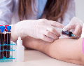 La hiperpotasemia sigue siendo una condición poco conocida pese a que puede convertirse en una emergencia médica silenciosa. CANVA