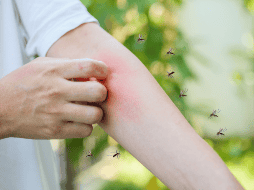 La respuesta tiene que ver con una combinación de factores biológicos, químicos y ambientales que hacen que ciertos individuos sean más fáciles de detectar para especies como Aedes aegypti, uno de los mosquitos más estudiados por la comunidad científica. CANVA