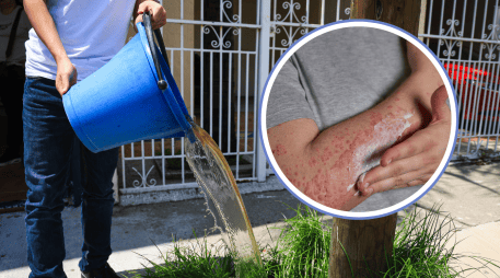 El funcionario cuestionó las evidencias de vecinos y organizaciones, quienes aseguran que tras bañarse y utilizar el agua contaminada que llega a sus viviendas han presentado enfermedades. EL INFORMADOR / ARCHIVO / FREEPIK / CANVA