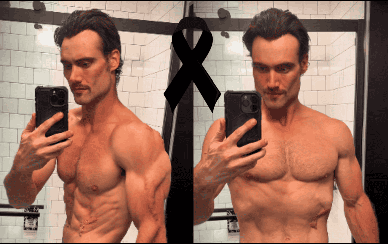 El trágico legado de Connor Murphy queda ahora plasmado como un sombrío y doloroso recordatorio de los frágiles límites del cuerpo humano y de las fatales consecuencias que la desinformación y la obsesión pueden generar en la actualidad. INSTAGRAM/@connormurphyofficial