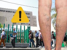 Ten en cuenta estas indicaciones si sufres de várices. EL INFORMADOR / ARCHIVO