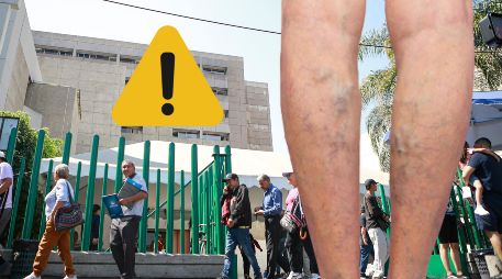 Ten en cuenta estas indicaciones si sufres de várices. EL INFORMADOR / ARCHIVO