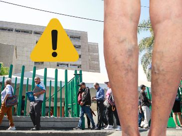 Ten en cuenta estas indicaciones si sufres de várices. EL INFORMADOR / ARCHIVO