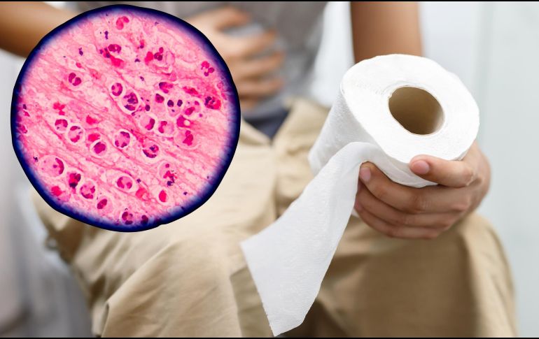 Ante una diarrea acuosa persistente, conviene acudir al médico. ESPECIAL / CANVA
