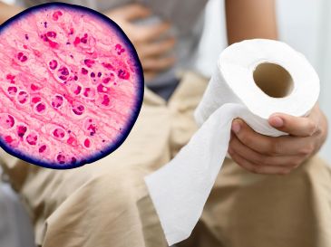 Ante una diarrea acuosa persistente, conviene acudir al médico. ESPECIAL / CANVA