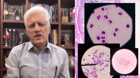 Los CDC informaron que, desde mayo, se han confirmado mil 645 casos de ciclosporiasis en Estados Unidos, cifra que representa un aumento de cuatro veces respecto al mismo periodo de 2025. FACEBOOK/Dr.AlejandroMacias