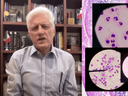 Los CDC informaron que, desde mayo, se han confirmado mil 645 casos de ciclosporiasis en Estados Unidos, cifra que representa un aumento de cuatro veces respecto al mismo periodo de 2025. FACEBOOK/Dr.AlejandroMacias