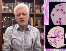 Los CDC informaron que, desde mayo, se han confirmado mil 645 casos de ciclosporiasis en Estados Unidos, cifra que representa un aumento de cuatro veces respecto al mismo periodo de 2025. FACEBOOK/Dr.AlejandroMacias