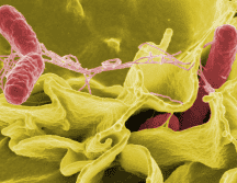 Los Centros para el Control y la Prevención de Enfermedades (CDC) estiman que cada año se reportan entre 150 y 200 infecciones por Vibrio vulnificus en Estados Unidos. CANVA
