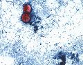 Esta fotografía tomada a través de un microscopio y difundida por los CDC muestra Cyclospora cayetanensis oocysts de una muestra de heces. AP/ARCHIVO