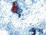 Esta fotografía tomada a través de un microscopio y difundida por los CDC muestra Cyclospora cayetanensis oocysts de una muestra de heces. AP/ARCHIVO