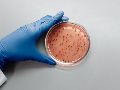 La cyclospora es un parásito microscópico que comúnmente causa diarrea y cuyos brotes ocurren a finales de la primavera y durante el verano. ESPECIAL/PEXELS