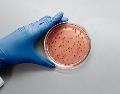 La cyclospora es un parásito microscópico que comúnmente causa diarrea y cuyos brotes ocurren a finales de la primavera y durante el verano. ESPECIAL/PEXELS