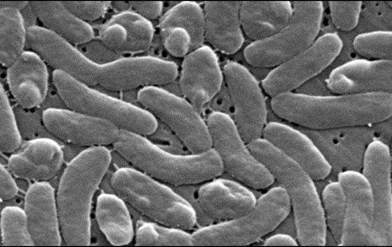 Imagen del microscopio electrónico de 2025 proporcionada por los Centros para el Control y la Prevención de Enfermedades de Estados Unidos (CDC) muestra bacterias Vibrio vulfinicus. AP/J. Haney Carr