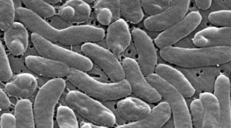 Imagen del microscopio electrónico de 2025 proporcionada por los Centros para el Control y la Prevención de Enfermedades de Estados Unidos (CDC) muestra bacterias Vibrio vulfinicus. AP/J. Haney Carr