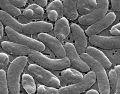 Imagen del microscopio electrónico de 2025 proporcionada por los Centros para el Control y la Prevención de Enfermedades de Estados Unidos (CDC) muestra bacterias Vibrio vulfinicus. AP/J. Haney Carr