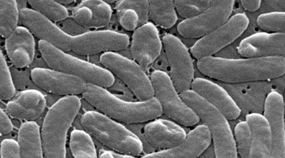 Imagen del microscopio electrónico de 2025 proporcionada por los Centros para el Control y la Prevención de Enfermedades de Estados Unidos (CDC) muestra bacterias Vibrio vulfinicus. AP/J. Haney Carr