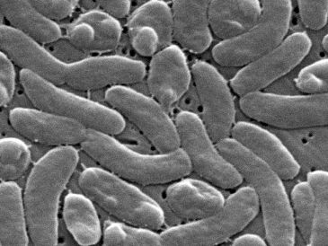 Imagen del microscopio electrónico de 2025 proporcionada por los Centros para el Control y la Prevención de Enfermedades de Estados Unidos (CDC) muestra bacterias Vibrio vulfinicus. AP/J. Haney Carr