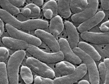 Imagen del microscopio electrónico de 2025 proporcionada por los Centros para el Control y la Prevención de Enfermedades de Estados Unidos (CDC) muestra bacterias Vibrio vulfinicus. AP/J. Haney Carr