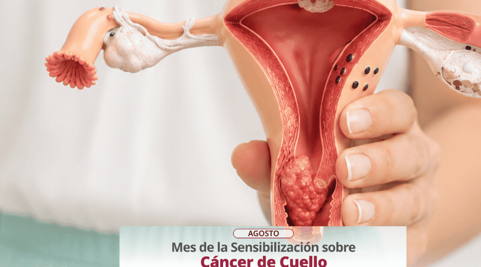Más allá de la vacunación, la detección temprana se realiza en clínicas y hospitales mediante el estudio de Papanicolaou y pruebas moleculares avanzadas. ESPECIAL/X/ @SSalud_mx