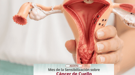 Más allá de la vacunación, la detección temprana se realiza en clínicas y hospitales mediante el estudio de Papanicolaou y pruebas moleculares avanzadas. ESPECIAL/X/ @SSalud_mx
