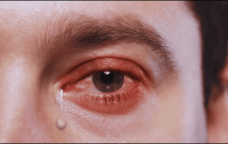 Frotarse los ojos, aunque parezca un alivio momentáneo, empeora drásticamente la situación. ESPECIAL / CANVA