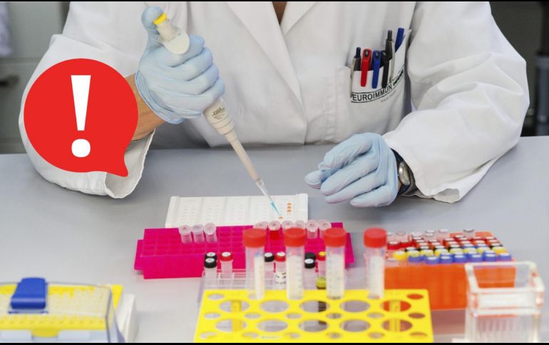 Los investigadores tienen previsto realizar un estudio para validar prospectivamente los hallazgos. EFE / ARCHIVO
