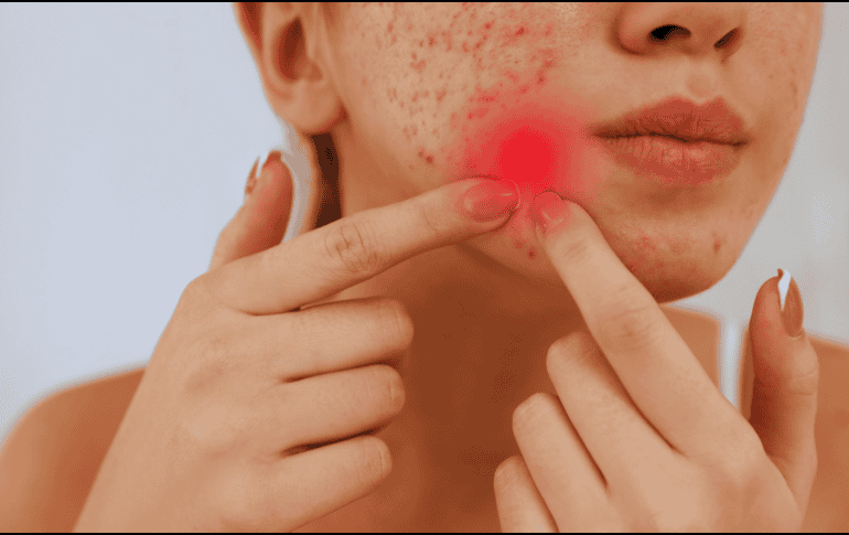 Mantener las manos alejadas del rostro sigue siendo la regla de oro indiscutible del cuidado facial. ESPECIAL / CANVA