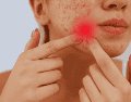Mantener las manos alejadas del rostro sigue siendo la regla de oro indiscutible del cuidado facial. ESPECIAL / CANVA