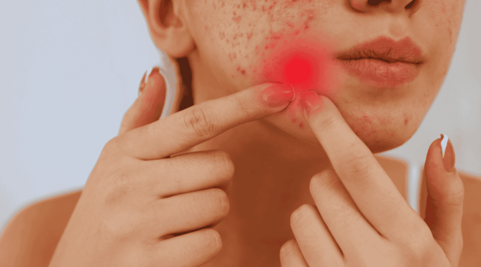 Mantener las manos alejadas del rostro sigue siendo la regla de oro indiscutible del cuidado facial. ESPECIAL / CANVA