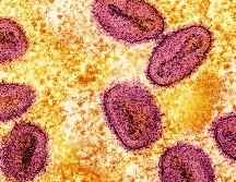 El Hospital General de México indicó que la investigación epidemiológica y sanitaria continúa para determinar la fuente específica de contaminación. UNSPLASH