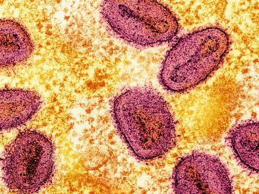 El Hospital General de México indicó que la investigación epidemiológica y sanitaria continúa para determinar la fuente específica de contaminación. UNSPLASH