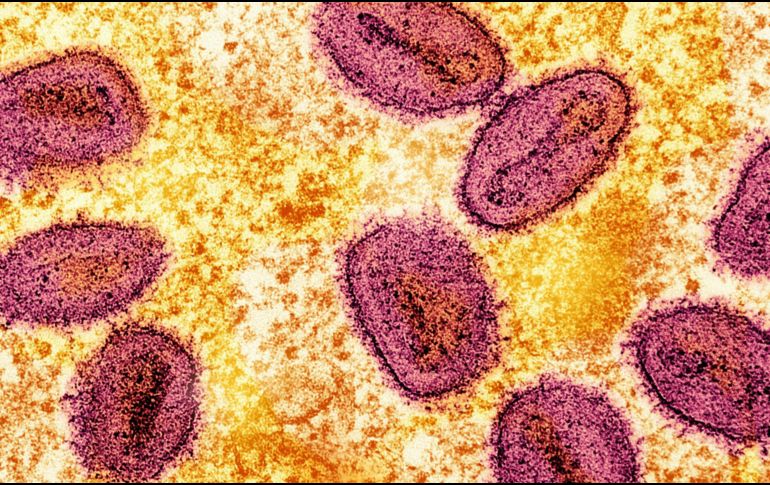 El Hospital General de México indicó que la investigación epidemiológica y sanitaria continúa para determinar la fuente específica de contaminación. UNSPLASH