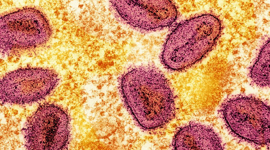 El Hospital General de México indicó que la investigación epidemiológica y sanitaria continúa para determinar la fuente específica de contaminación. UNSPLASH