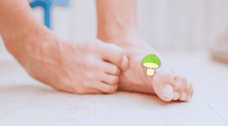La Organización Mundial de la Salud (OMS) advierte que las infecciones fúngicas superficiales afectan a una cuarta parte de la población mundial. ESPECIAL / CANVA