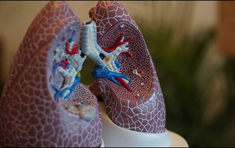 Entre las personas que nunca fumaron, los portadores tenían más de 60 veces más probabilidades de desarrollar cáncer de pulmón. Unsplash