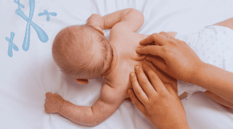 Vivir con esta condición implica enfrentar múltiples retos médicos desde el momento del nacimiento. ESPECIAL / CANVA