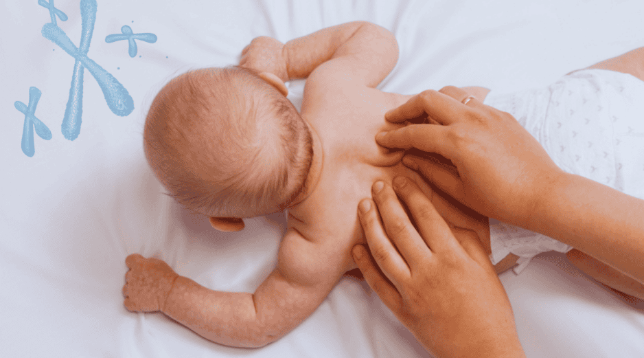 Vivir con esta condición implica enfrentar múltiples retos médicos desde el momento del nacimiento. ESPECIAL / CANVA